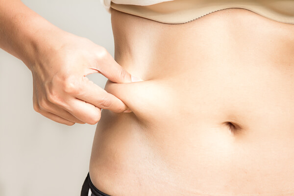 Abdominoplasty